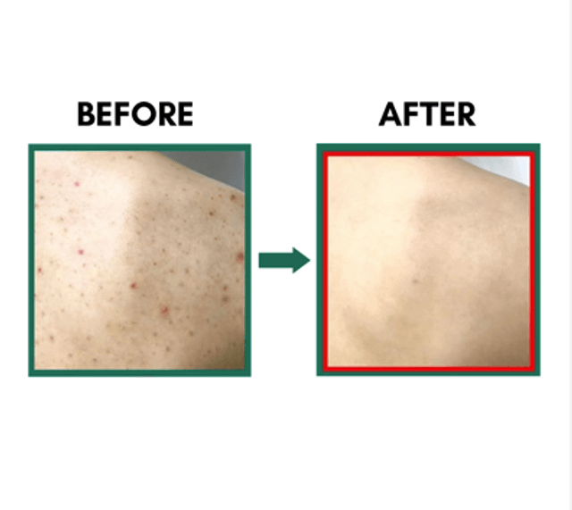 SOME BY MI - AHA-BHA-PHA 30 Days Miracle Acne Clear Body Cleanser